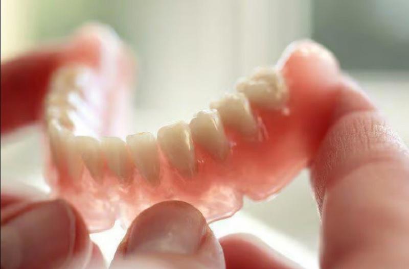 Protesa Gigi Jogja Cara Efektif Kembalikan Fungsi Gigi yang Hilang